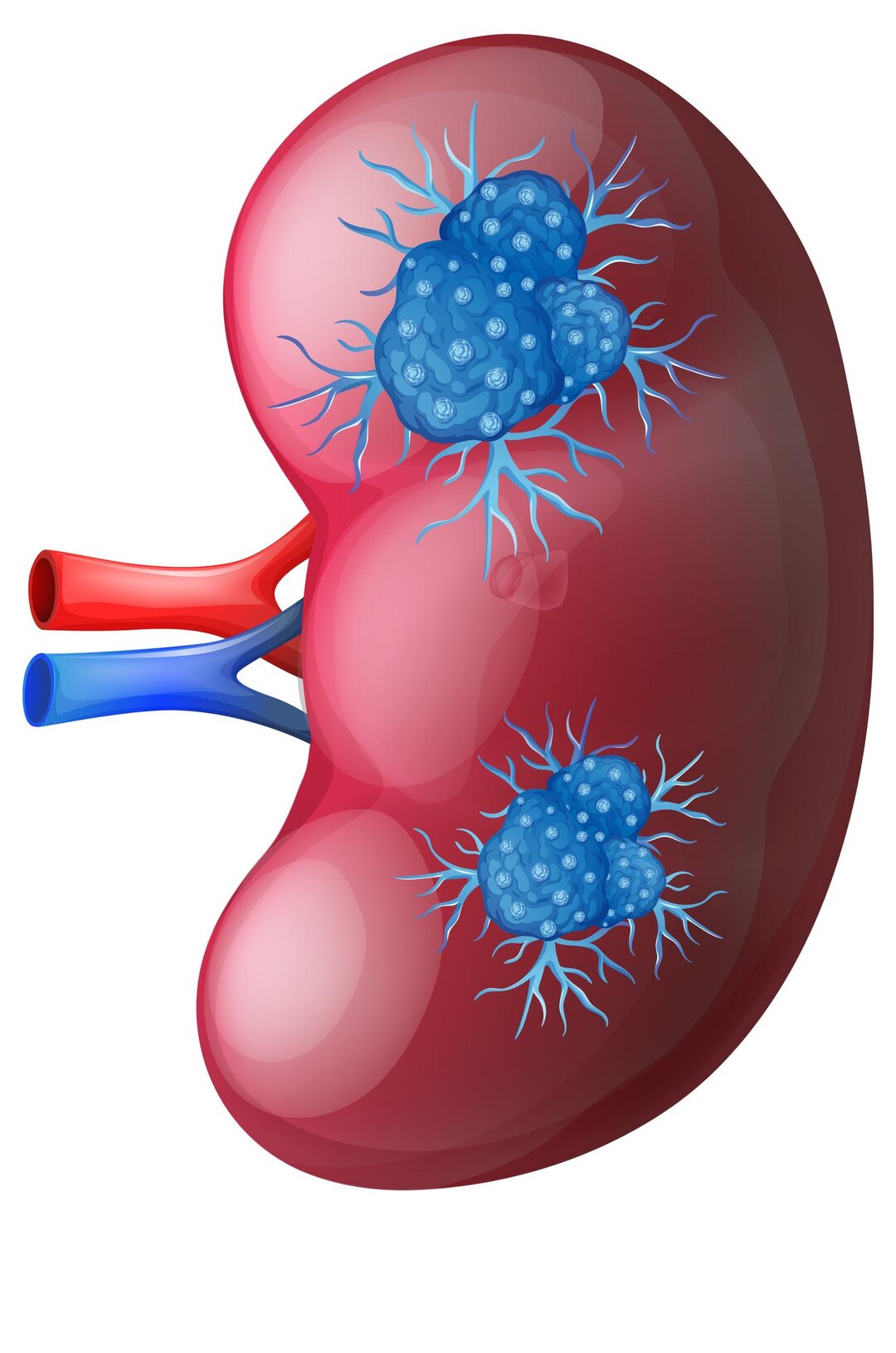 laparoscopic surgery in ahmedabad
