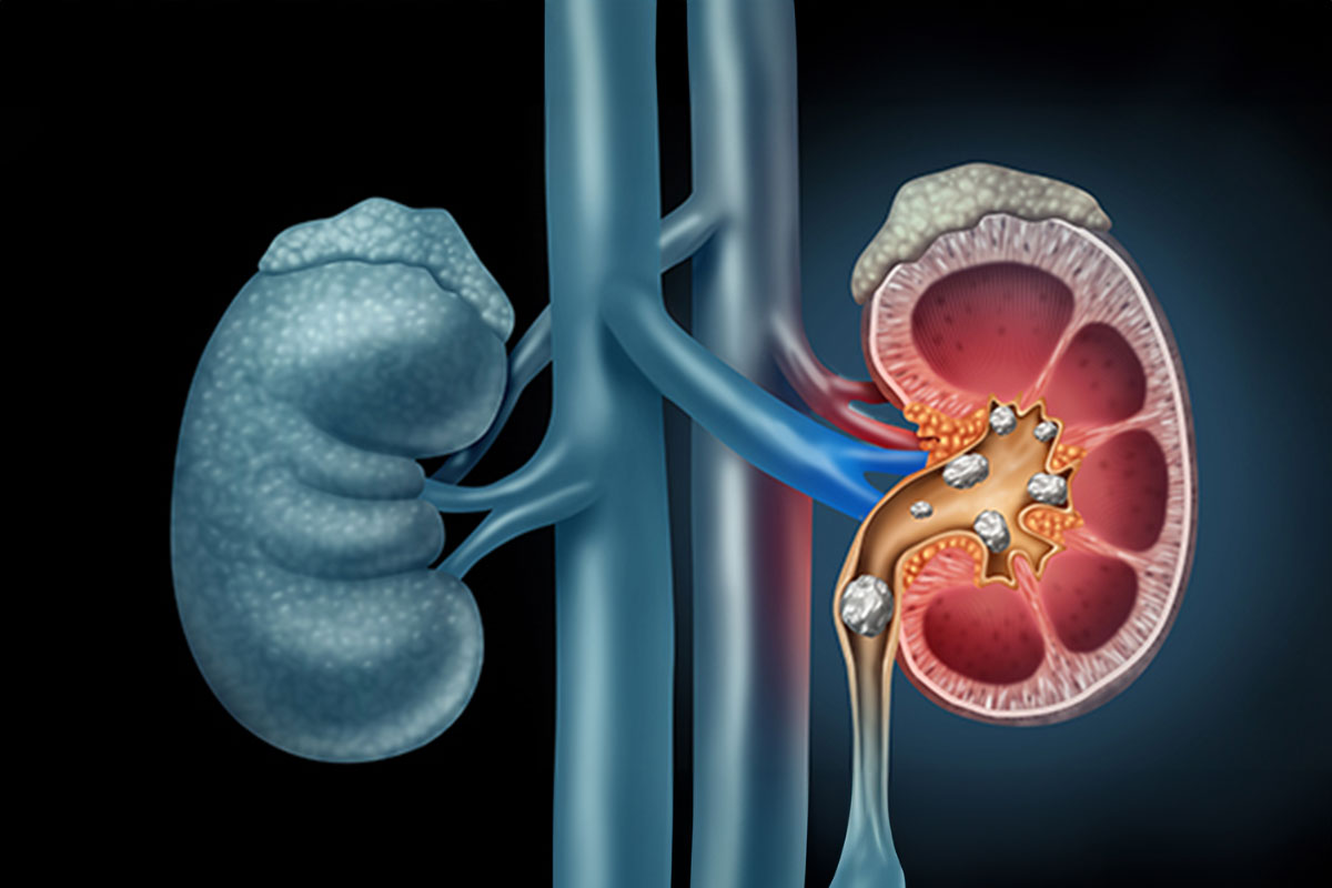 Best Urology Hospital in Shahibaug Ahmedabad  
