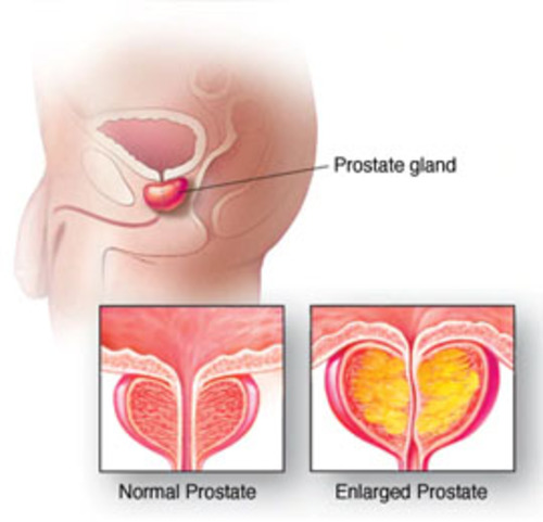 Kidney specialist in Shahibaug
